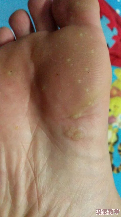 固定手脚的痒女生的脚心：为什么会出现这种情况？