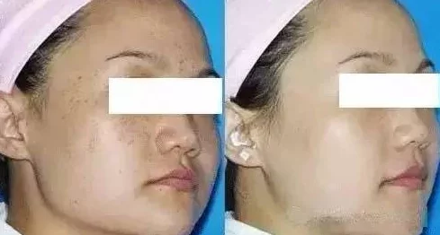 一面膜胸口一面膜下部位真人，展示了不同区域使用面膜的效果与体验，让人们了解护肤的多样性和重要性